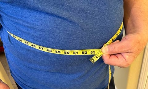 Obesity won't be solely defined by BMI under new plan for diagnosis by global experts