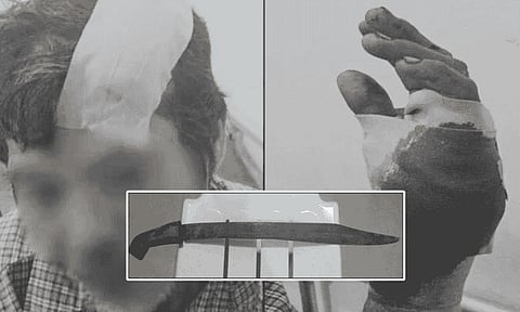 Father injured after being attacked by daughter with a 'pinote'