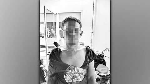 Dunggan naputol kay gipaak sa ig-agaw