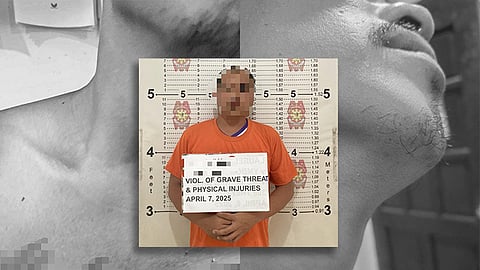 2 ka polis sikop sa buy-bust, ‘nangulata’