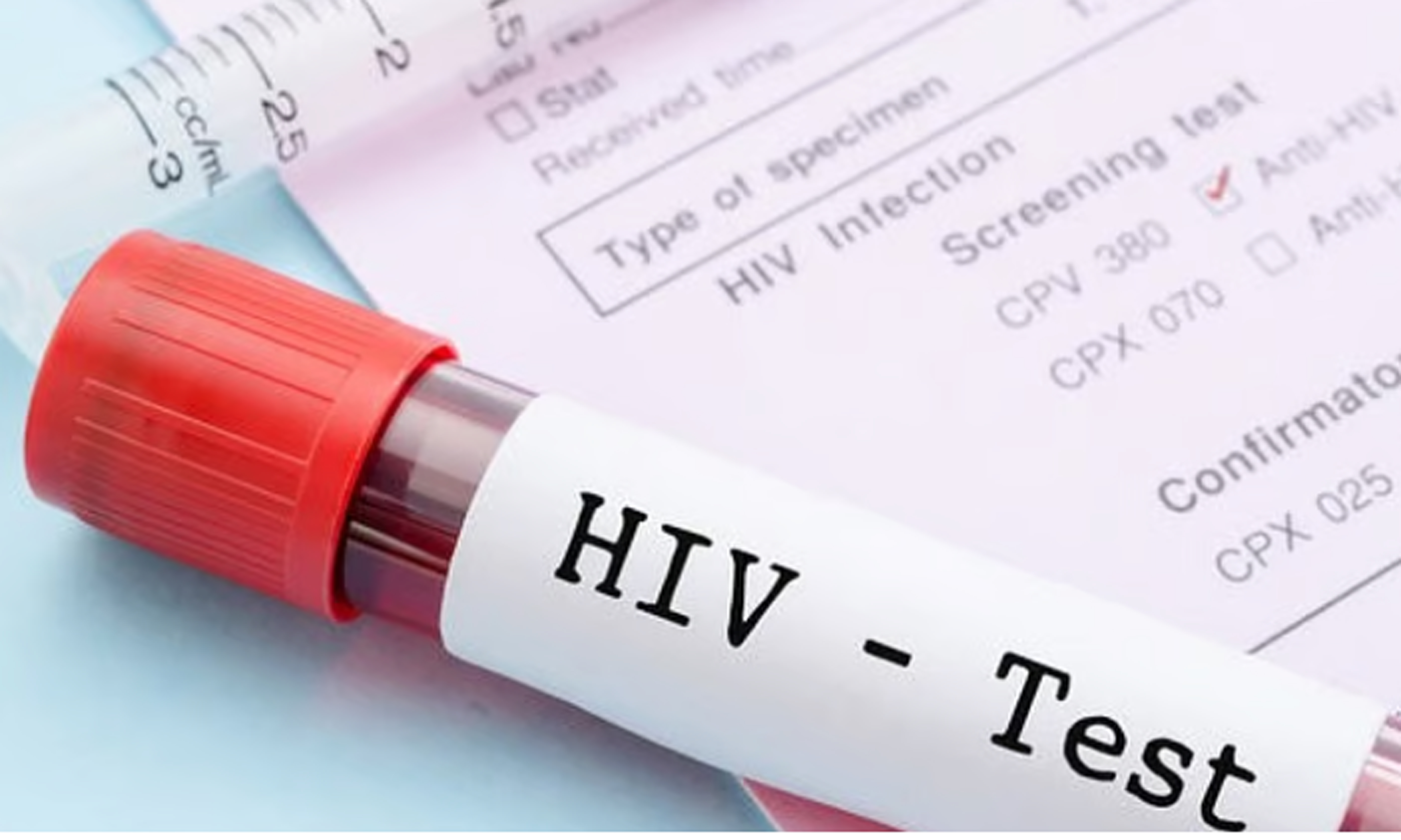 117 kaso sa HIV natala sa Davao 