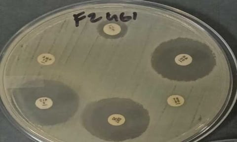 University of the Philippines researchers have developed AI models to predict E. coli's antimicrobial resistance using genetic data, offering a faster solution for monitoring and preventing outbreaks in agriculture and public health.