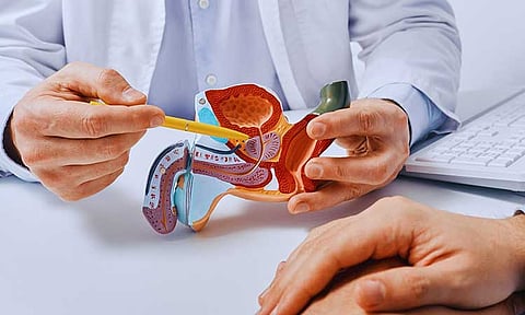 Early screening for prostate cancer urged