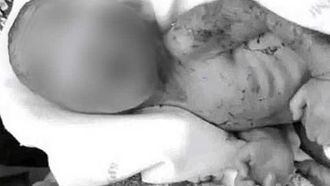 The newborn baby whose brief revival drew widespread attention online was confirmed to have died early on August 25, with doctors identifying the rare Lazarus Syndrome as one of the possible reasons for the unexpected signs of life hours after he was first declared dead.