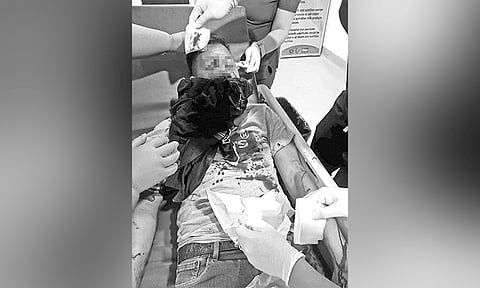 Mata sa polis ang gidunggab