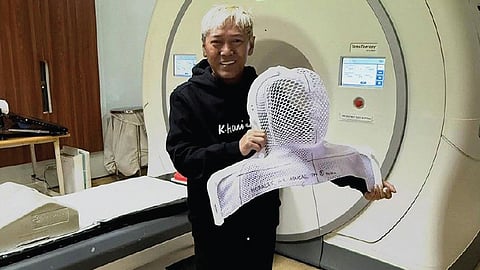 Ate Gay completes chemotherapy