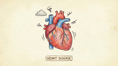 Sakit sa kasingkasing nag-una nga hinungdan sa kamatayon 