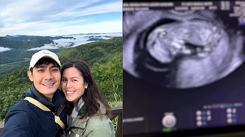 Robi Domingo, wife are expecting their first child 