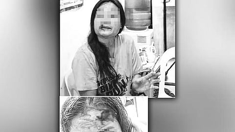 AGTANG NAPAHAK: Nag-atubang sa Inayawan Police Station ang biktima ug ang suspek aron husayon ang ilang panagbangi human sa pagnagbugno. Nalangkat ang panit ug unod sa agtang sa biktima. Ikaduha na kining higayon nga namaak ang suspek, diin ang unang nabiktima usa ka barangay tanod sa Barangay Inayawan, Dakbayan sa Sugbo. 