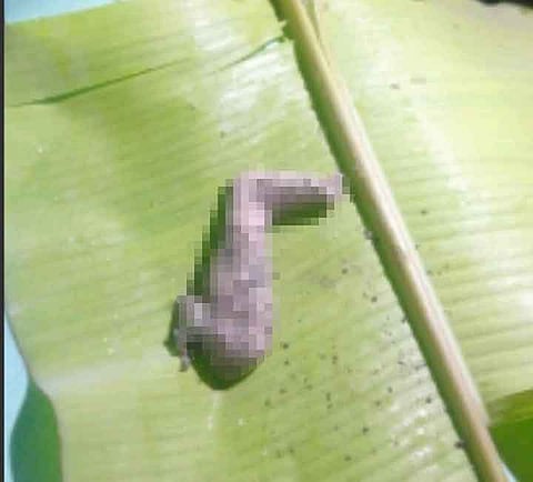 Putol nga tiil sa bata, napalgan sa pansayan