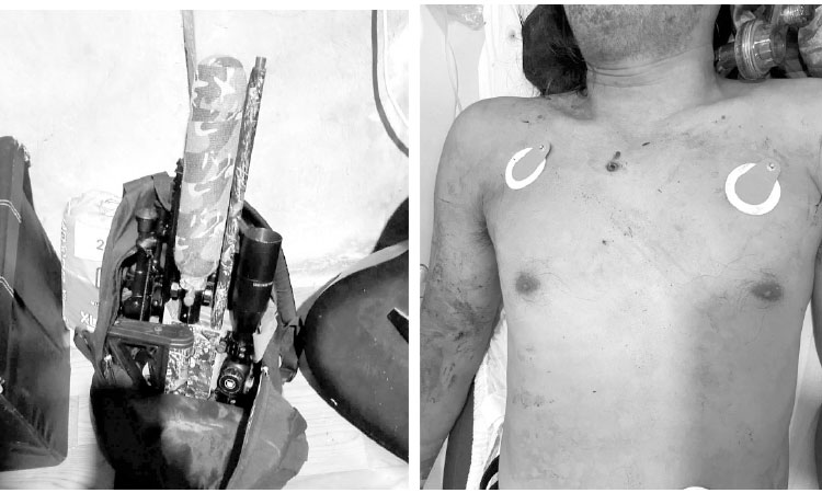 ‘Bird hunter’ naunay sa iyang airgun, patay