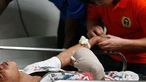Fireworks-related injuries in CV hit 81
