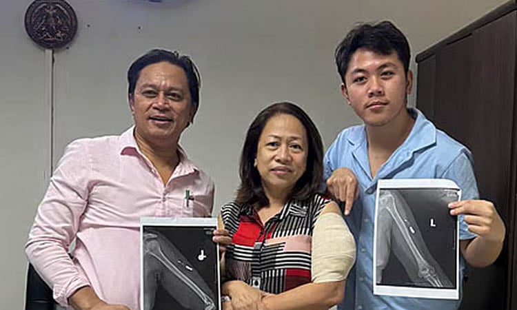 Cebu Official Finally Removes 2019 Ambush Bullet After 6 Years