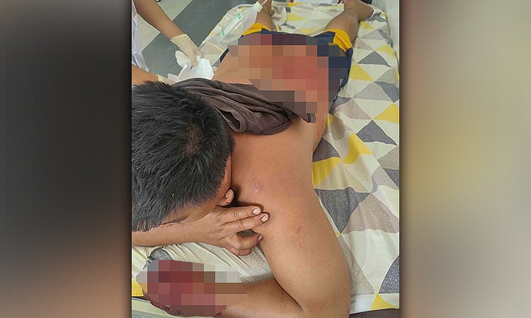 Oslob Stabbing: Fish Vendor Arrested for Frustrated Homicide After Alleged Bullying