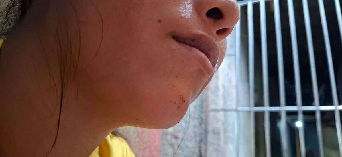 Cebu City Vendor Injured in Probe Team Altercation at Plaza Sugbo
