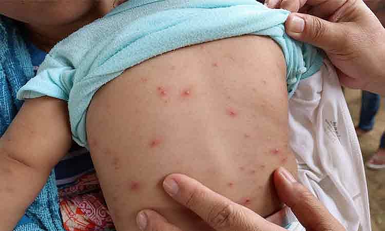 Davao Councilor Seeks Inquiry into Skin Clinic Safety After Fatal Overdose