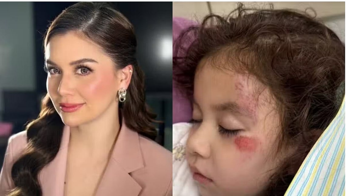 Nadine Samonte’s daughter hospitalized after head injury
