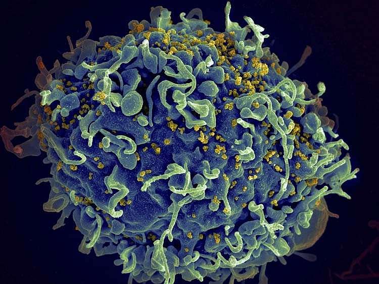 DOH Official Urges Open Safe Sex Talks to Fight HIV in Philippines