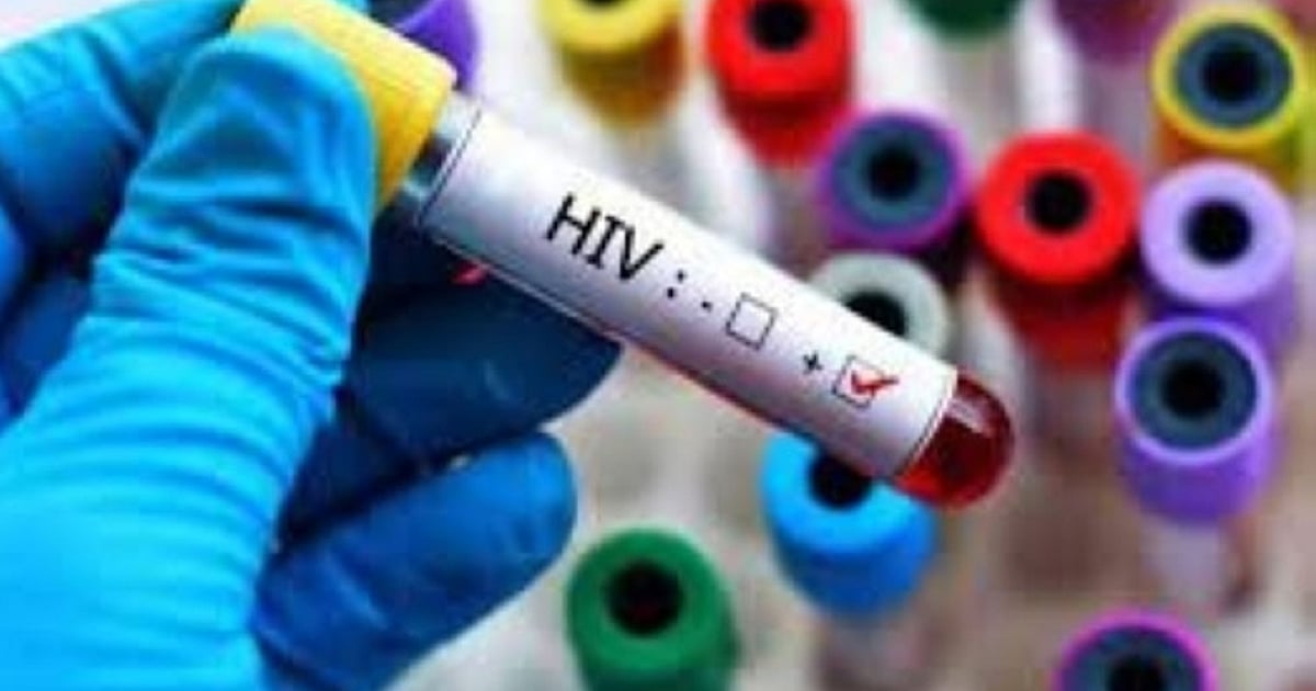 PhilHealth, DOH to include HIV testing in medical package