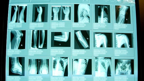 High resolution digital x-rays are seen in the emergency room at Coney Island Hospital, in New York City. (Mario Tama/Getty Images)