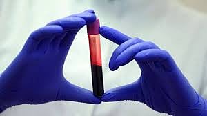A rare blood type found in only 3 people worldwide - scientists' discovery!