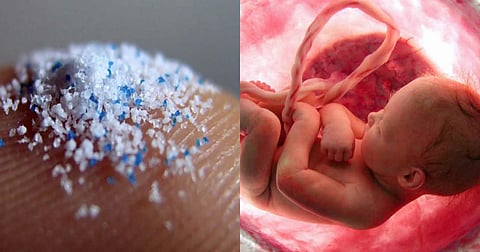 Microplastic particles in the mother's placenta.