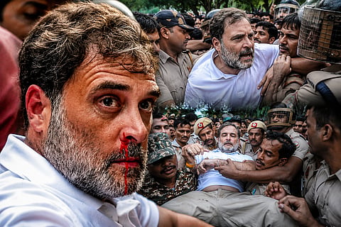 Rahul Gandhi, participating in a protest by  'Cockroach Party' suffered a nosebleed during arrest