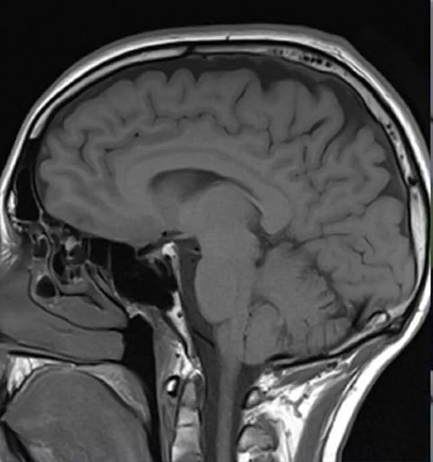 Representation image of a Human Brain 