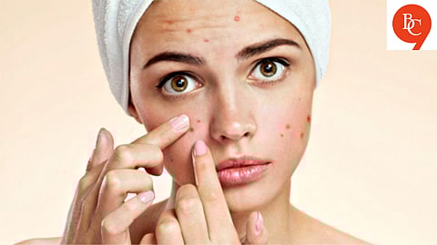 Skincare Mistakes That Might Be Making Your Acne Worse