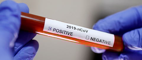 Coronavirus Mumbai: Media professionals test positive