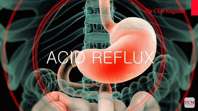 What is Acid Reflux?