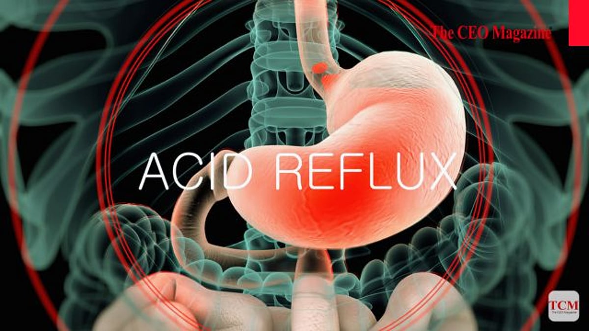 Avid Reflux Color What is Acid Reflux?