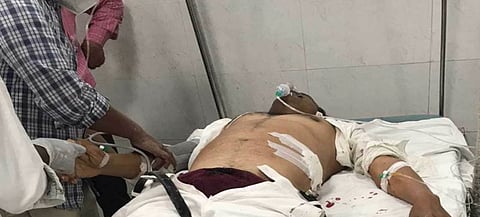 One Injured In Firing Among Candidates In Gorakhpur As Ist Phase Of Panchayat Polls Underway In UP