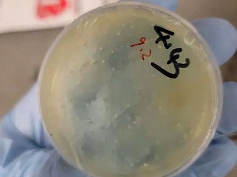 FBI Arrests Second Chinese National On Charges Of Smuggling Biological Materials Into The US