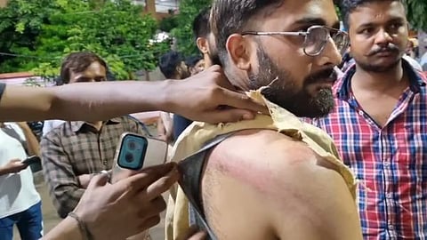 Yogi Cracks Whip On Cops Responsible For Barbaric Cane Charge On Students of Shri Ramswaroop Memorial University 