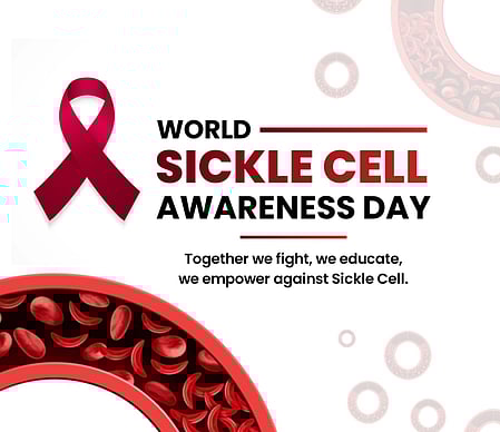 5.72 crore people screened for Sickle Cell Disease: Union government