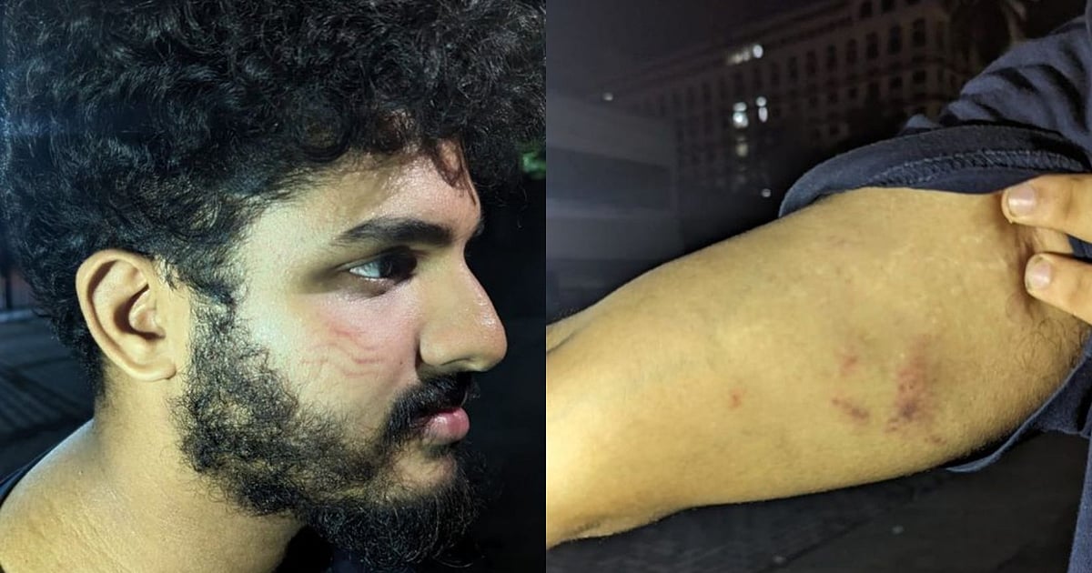 CPI M Members Attack Journalist Friend Who Staged Protest At Nava cpi-m-members-attack-journalist-friend-who-staged-protest-at-nava