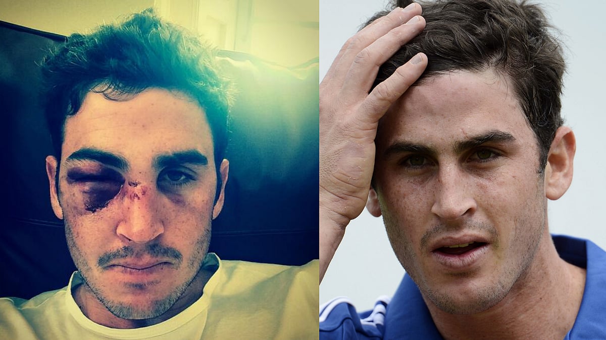A member of England’s World T20 winning squad, Kieswetter’s career has met an abrupt end after he was hit on the eye with a ball during a match last year. (Photo courtesy: twitter.com/kiesy_22)