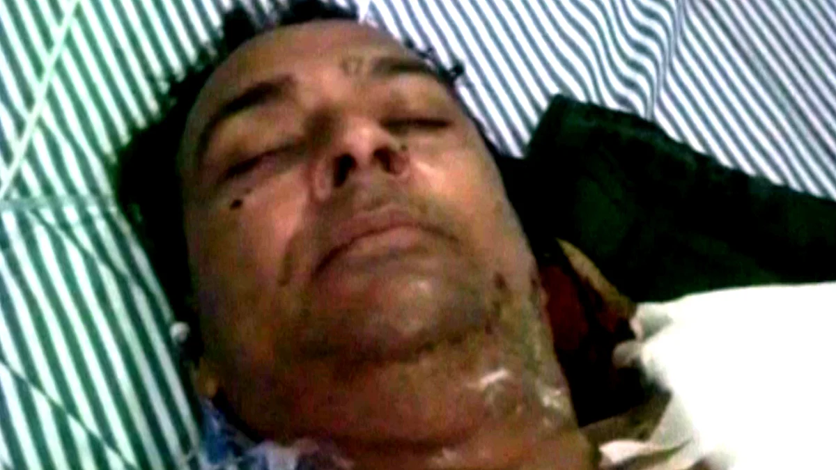 Kamaljit Singh, survivor of the Pubjab terror attack. (Photo: ANI screengrab)