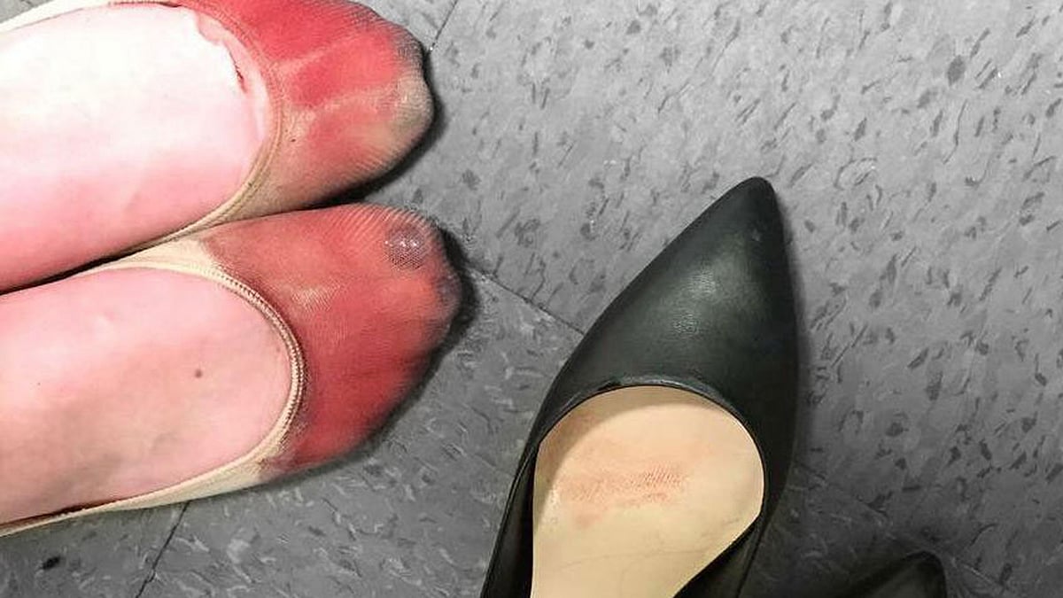 The bloodied feet of a waitress forced to work her shift in high heels (Photo Courtesy: <a href="https://www.facebook.com/nicola.gavins/posts/10156847278270162">Facebook/Nicola Gavins</a>)