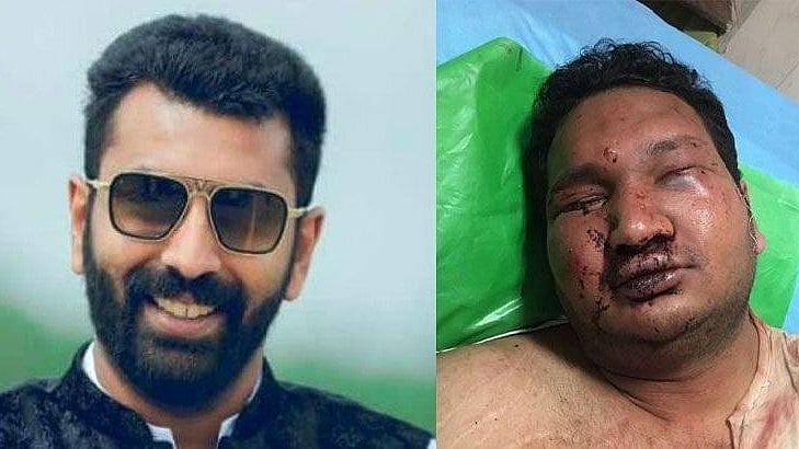 Nalapad was arrested after he and friends brutally assaulted 24-year-old Vidvat, son of a prominent businessman.