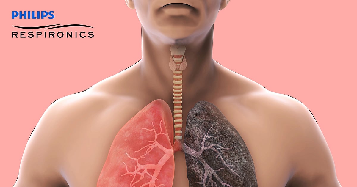 In India, over 5.5 crore people live their lives struggling to breathe as they battle progressive lung diseases.
