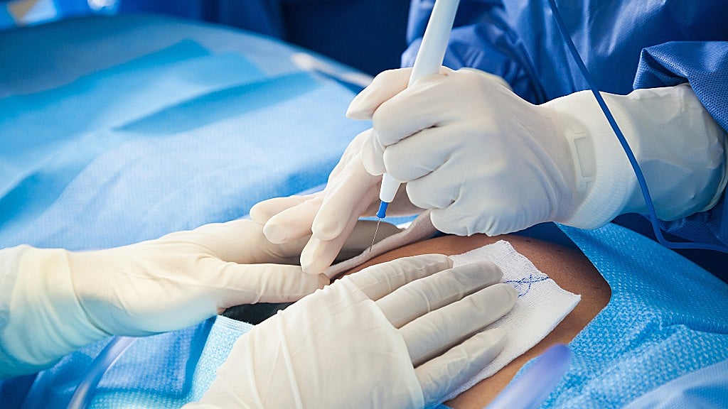 Spinal cord injuries  can cause devastating damage, including loss of mobility and sensation.