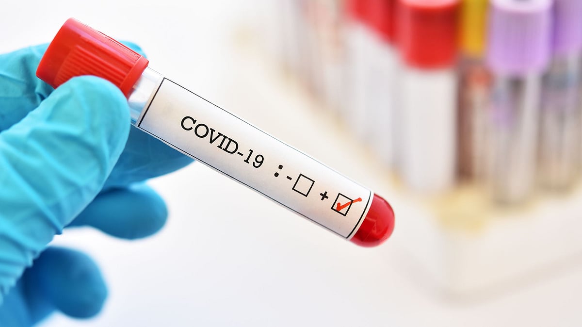 Blood sample tube positive with COVID-19