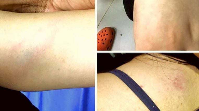 The girl was brutally attacked by an elderly woman, her son and daughter-in-law.
