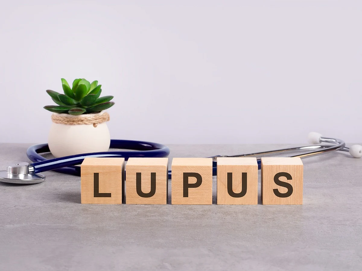 <div class="paragraphs"><p>Know the causes, symptoms, diagnosis, and treatment of lupus in detail</p></div>