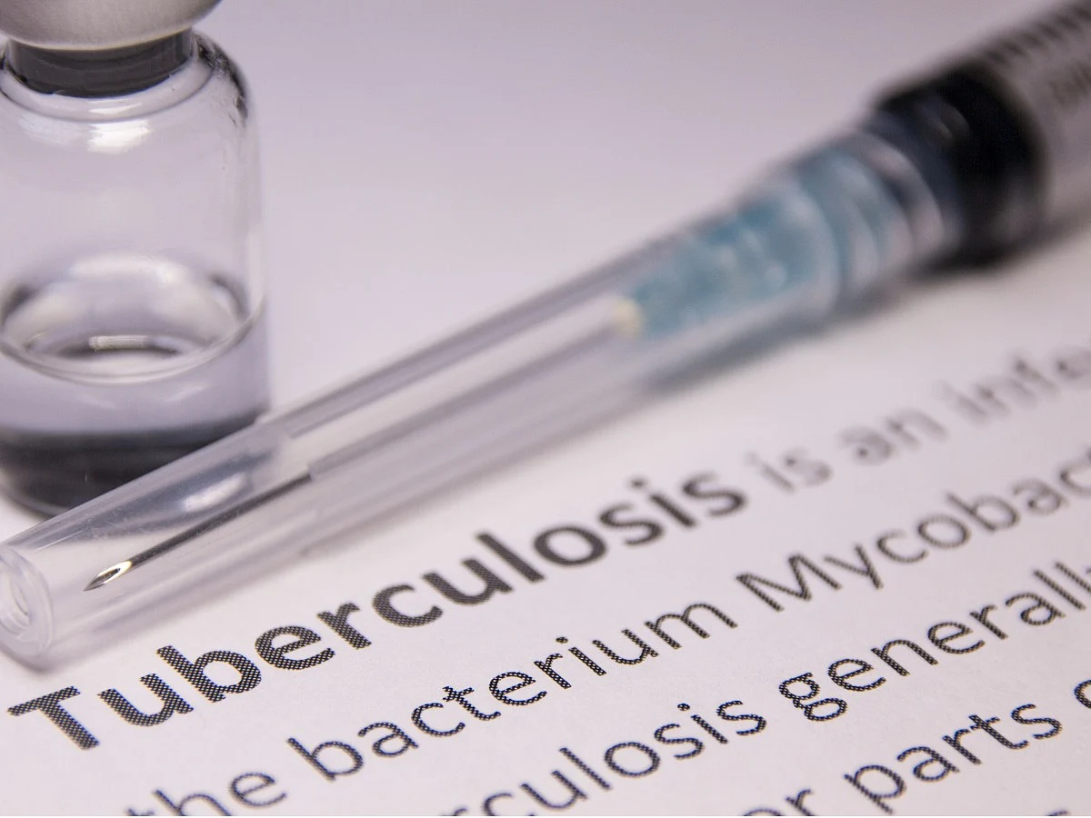<div class="paragraphs"><p>Know the causes, symptoms, diagnosis, and treatment for tuberculosis.</p></div>