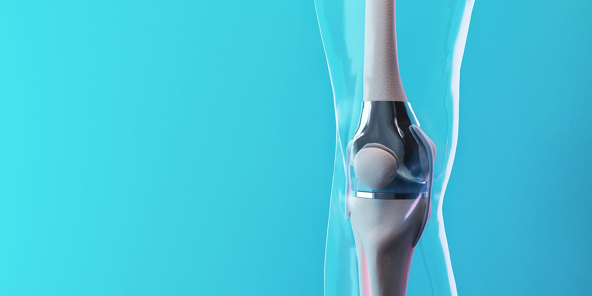 <div class="paragraphs"><p>How Orthohub Solutions Is Giving New Hope To India's Ortho Implants Industry</p></div>