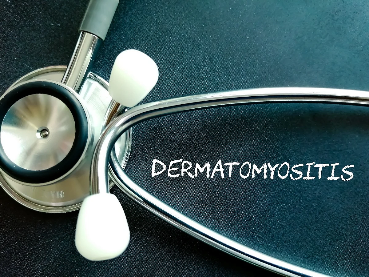 <div class="paragraphs"><p>Know about causes, symptoms, diagnosis tests, and treatment for dermatomyositis</p></div>