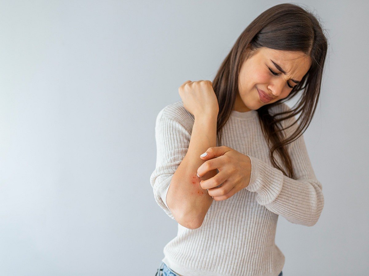 <div class="paragraphs"><p>Home Remedies for itchy skin in psoriasis</p></div>